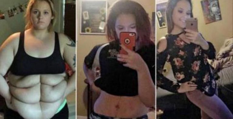 La Transformación De La Mujer Que Bajó 76 Kilos Y Usó Bikini Por Primera Vez Nuevo Diario Web 2585