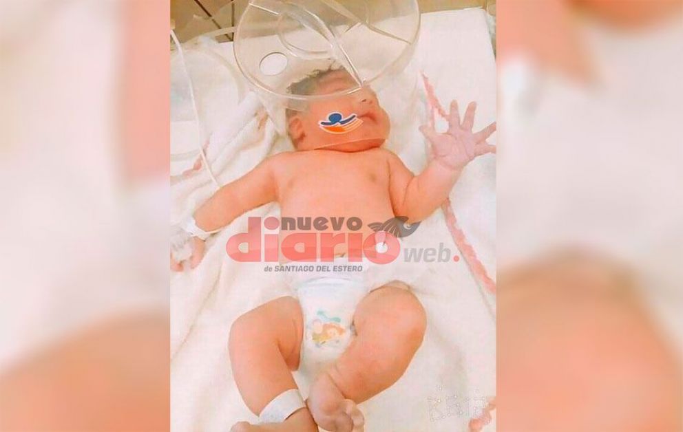 Nació un súper bebé en el hospital Regional y necesita ayuda | Nuevo Diario  Web | Santiago del Estero