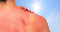 Afirman que además del sol, el estado de ánimo influye en la salud de la piel